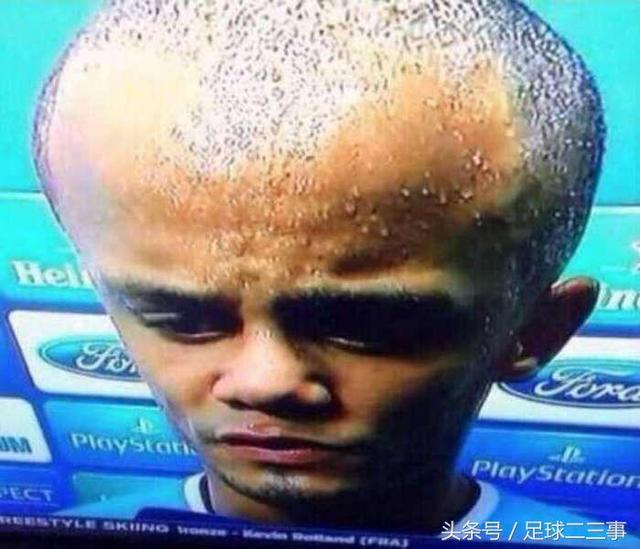 包含冲刺阶段拉齐奥调整名单以备亚冠费德勒在MAD比赛中逆转，阿森纳今晚扳平良机直接炸裂的词条